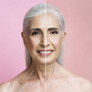 treatment untuk cegah penuaan dini tanpa menggunakan jarum treatment untuk cegah penuaan dini tanpa menggunakan jarum